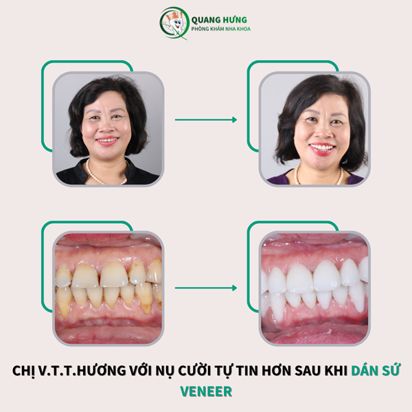 Cam kết hiệu quả sau khi sử dụng dịch vụ