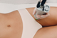 Triệt Lông Bikini Toàn Bộ Diode Laser 10 Buổi - 25 Phút